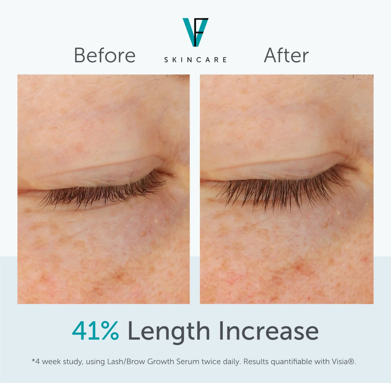 FactorFive Lash/Brow Growth Serum