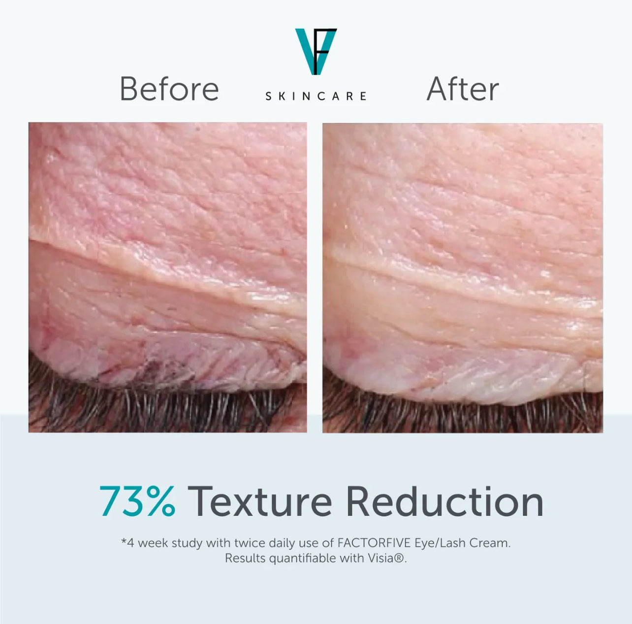 FactorFive Eye/Lash Cream