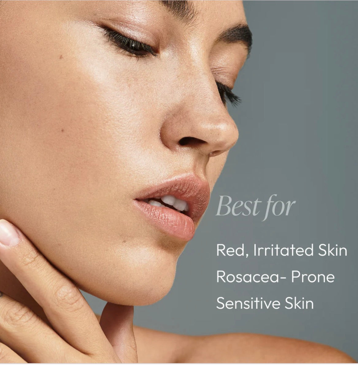 Rose-Ease Relief Cream